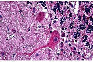 Human Brain, Cerebellum: Formalin-Fixed, Paraffin-Embedded (FFPE)