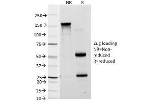 SDS-PAGE Analysis Purified Lewis A Monoclonal Antibody (7LE). (Blood Group Lewis A anticorps)