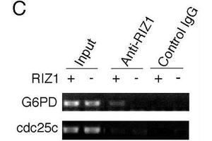 Image no. 3 for anti-PR Domain Containing 2, with ZNF Domain (PRDM2) antibody (ABIN2995299)