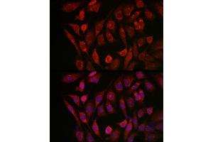 Immunofluorescence analysis of NIH/3T3 cells using Cathepsin B Rabbit pAb (ABIN3021175, ABIN3021176, ABIN3021177 and ABIN6214050) at dilution of 1:100 (40x lens). (Cathepsin B anticorps  (AA 1-339))