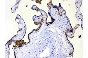 ALPP was detected in paraffin-embedded sections of human placenta tissues using rabbit anti- ALPP Antigen Affinity purified polyclonal antibody (Catalog # ) at 1 µg/mL.