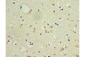 Immunohistochemistry of paraffin-embedded human brain tissue using ABIN7153991 at dilution of 1:100 (GRIN2B anticorps  (AA 1185-1484))