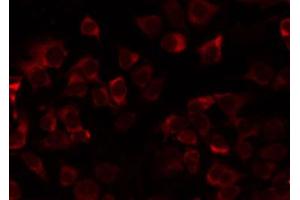 ABIN6274735 staining COLO205 by IF/ICC. (MRPL21 anticorps  (Internal Region))