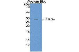 Western Blotting (WB) image for anti-Glutathione S-Transferase theta 1 (GSTT1) (AA 7-240) antibody (ABIN1868284) (GSTT1 anticorps  (AA 7-240))