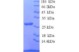 Interleukin 12b (IL12B) (AA 23-327), (full length) protein (His tag)