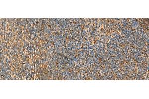 Immunohistochemistry of paraffin-embedded Human tonsil tissue using PPP1R1A Polyclonal Antibody at dilution of 1:50(x200)