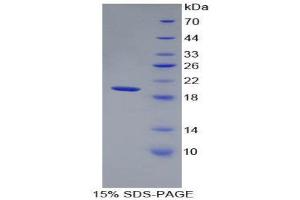 SDS-PAGE (SDS) image for Matrix Metallopeptidase 9 (Gelatinase B, 92kDa Gelatinase, 92kDa Type IV Collagenase) (MMP9) (AA 225-413) protein (His tag) (ABIN1980762) (MMP 9 Protein (AA 225-413) (His tag))