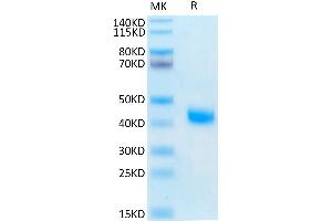 IL2 Receptor beta Protein (AA 27-239) (His-Avi Tag)