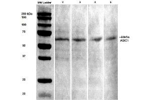 Western Blot analysis of Rat brain lysates showing detection of ASIC1 protein using Mouse Anti-ASIC1 Monoclonal Antibody, Clone S271-44 . (ASIC1 anticorps  (AA 460-526) (Biotin))