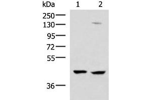 Western blot analysis of 293T and Jurkat cell lysates using MAGEC2 Polyclonal Antibody at dilution of 1:850 (MAGEC2 anticorps)