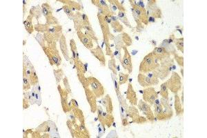 Immunohistochemistry of paraffin-embedded Mouse heart using HNMT Polyclonal Antibody at dilution of 1:100 (40x lens). (HNMT anticorps)