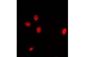 anti-Inhibitor of Growth Family, Member 3 (ING3) antibody