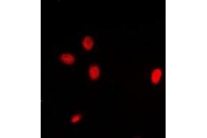 Immunofluorescent analysis of ING3 staining in Hela cells. (ING3 anticorps)