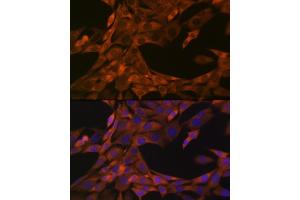 Immunofluorescence analysis of NIH-3T3 cells using HE4/WFDC2 Rabbit mAb (ABIN1682653, ABIN3017632, ABIN3017633 and ABIN7101513) at dilution of 1:100 (40x lens). (WFDC2 anticorps)