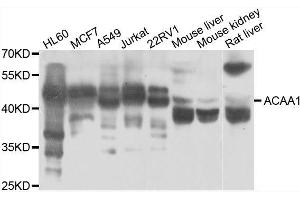 Western blot analysis of extracts of various cell lines, using ACAA1 antibody.