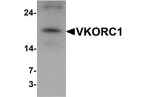 Western blot analysis of VKORC1 in A549 cell lysate with VKORC1 antibody at 1 ug/mL. (VKORC1 anticorps  (N-Term))