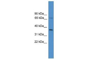 WB Suggested Anti-ELL2 Antibody Titration:  0. (ELL2 anticorps  (C-Term))