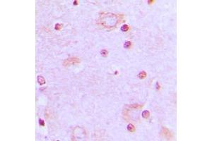 Immunohistochemical analysis of SRSF7 staining in human brain formalin fixed paraffin embedded tissue section.