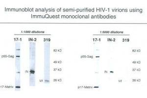 Image no. 1 for anti-Human Immunodeficiency Virus 1 Matrix (HIV-1 p17) (N-Term) antibody (ABIN1042608) (HIV-1 p17 anticorps  (N-Term))