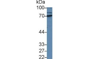 Western blot analysis of Rat Liver lysate, using Rabbit Anti-Rat MMP1 Antibody (1 µg/ml) and HRP-conjugated Goat Anti-Rabbit antibody (abx400043, 0. (MMP1 anticorps  (AA 169-464))