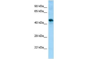 WB Suggested Anti-Sgms1 Antibody Titration: 1. (Sphingomyelin Synthase 1 anticorps  (Middle Region))