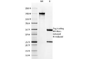 SDS-PAGE Analysis Purified Cytokeratin 6A (KRT6A) Mouse Monoclonal Antibody (KRT6A/2368). (KRT6A anticorps)