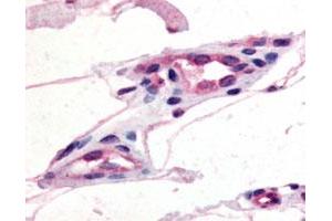 Immunohistochemical (Formalin/PFA-fixed paraffin-embedded sections) staining of human capillaries with GPR21 polyclonal antibody . (GPR21 anticorps)