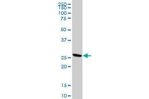 KLK10 polyclonal antibody (A01), Lot # 051011JC01 Western Blot analysis of KLK10 expression in A-431 .