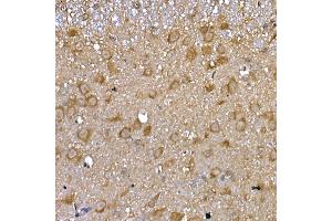 Immunohistochemistry of paraffin-embedded mouse spinal cord using GFR Rabbit pAb (ABIN6127950, ABIN6141065, ABIN6141066 and ABIN6221017) at dilution of 1:100 (40x lens).