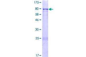 Image no. 1 for Coiled-Coil Domain Containing 65 (CCDC65) (AA 1-484) protein (GST tag) (ABIN1348314)