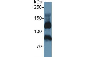 Detection of ITIH4 in Human Serum using Polyclonal Antibody to Inter Alpha-Globulin Inhibitor H4 (ITIH4)