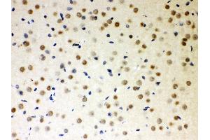 Anti- PKC iota Picoband antibody,IHC(P) IHC(P): Rat Brain Tissue (PKC iota anticorps  (AA 21-214))