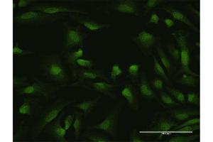 Immunofluorescence of purified MaxPab antibody to IKZF1 on HeLa cell. (IKZF1 anticorps  (AA 1-477))