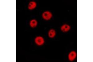 ABIN6277676 staining  NIH-3T3 cells by IF/ICC. (FLI1 anticorps  (Internal Region))