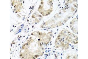 Immunohistochemistry of paraffin-embedded Human stomach using PCBP1 Polyclonal Antibody at dilution of 1:100 (40x lens). (PCBP1 anticorps)