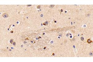 Detection of GbL in Porcine Cerebrum Tissue using Polyclonal Antibody to G Protein Beta Subunit Like Protein (GbL)