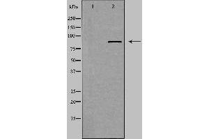 Western blot analysis of extracts from Jurkat cells using ZFYVE20 antibody.