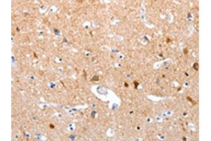 The image on the left is immunohistochemistry of paraffin-embedded Human brain tissue using ABIN7190855(GPR6 Antibody) at dilution 1/10, on the right is treated with synthetic peptide. (GPR6 anticorps)