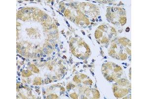 Immunohistochemistry of paraffin-embedded Human stomach using PMPCB Polyclonal Antibody at dilution of 1:100 (40x lens). (PMPCB anticorps)