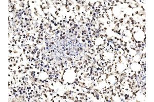 IHC analysis of DBC-1/CCAR2 using anti-DBC-1/CCAR2 antibody (ABIN7602235). (CCAR2 anticorps  (AA 65-917))