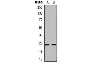 Western blot analysis of PLUNC expression in A549 (A), PC12 (B) whole cell lysates. (BPIFA1 anticorps  (Center))