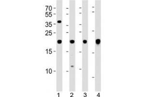 Western blot analysis of lysate from 1) U-87 MG, 2) SK-N-MC cell line, 3) human heart and 4) mouse heart tissue using HES5 antibody at 1:1000. (HES5 anticorps)