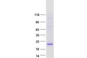Validation with Western Blot