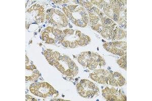 Immunohistochemistry of paraffin-embedded human stomach using VEPH1 antibody. (VEPH1 anticorps  (AA 448-547))