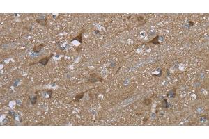Immunohistochemistry of paraffin-embedded Human brain using PTK2B Polyclonal Antibody at dilution of 1:50