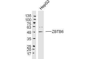 HepG2 lysates probed with ZBTB6 Polyclonal Antibody, Unconjugated  at 1:300 dilution and 4˚C overnight incubation. (ZBTB6 anticorps  (AA 351-424))