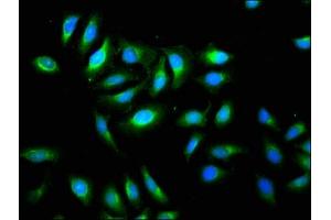 Immunofluorescence staining of A549 cells with ABIN7173123 at 1:133, counter-stained with DAPI.