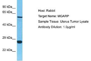 Host: Rabbit Target Name: MGARP Sample Tissue: Human Uterus Tumor Antibody Dilution: 1ug/ml (C4orf49 anticorps  (C-Term))