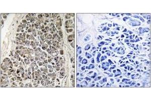 Immunohistochemistry analysis of paraffin-embedded human pancreas tissue, using MRPS21 Antibody.