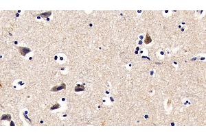 Detection of FMOD in Porcine Cerebrum Tissue using Polyclonal Antibody to Fibromodulin (FMOD)